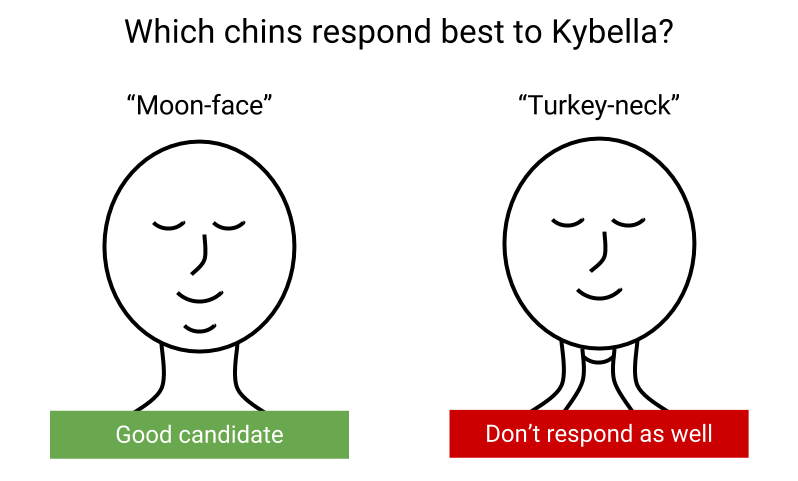 Kybella Chin Type Response